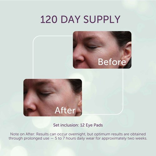 SilcSkin Silicone Eye Pads - Reusable Overnight Eye Patches, Medical-grade Silicone for Fine Lines, Crepey Skin, and Puffiness - 120 Day Supply