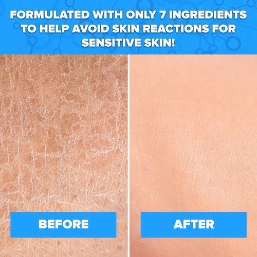 Aquanil Cleanser 16 oz (Pack of 4)