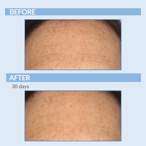 Serious Skincare A Force XR Serum Retinol Concentrate - Vitamin A - Time Released – Lightweight Anti-Aging & Anti-Wrinkle Facial Treatment – Green Tea Leaf Extract - 2 oz.