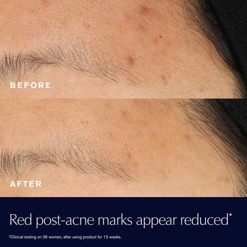 Estée Lauder Advanced Night Repair Rescue Solution with 15% Bifidus Ferment to Reduce Visible Redness, 0.68 Fl Oz