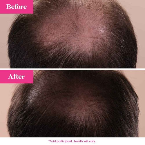 Grande Cosmetics GrandeHAIR Enhancing Hair Serum - for Men & Women, for Fuller & Thicker-Looking Hair in 8 weeks, Safe for Color-Treated Hair (40 mL)