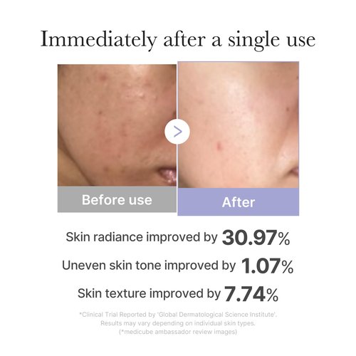 medicube Affordable Teen Glow Essentials Duo: Mini Booster Pro Pink and Collagen Jelly Cream 50ml | Holiday Stocking Stuffers, Gifts for Women, Gifts for Mom, Gifts for Girls