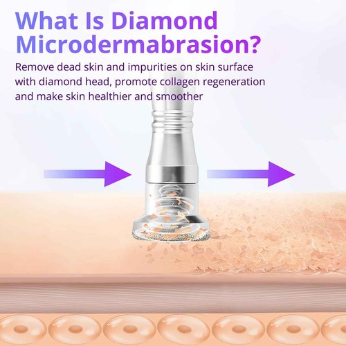 UNOISETION Diamond Microdermabrasion Machine with 250Pcs Microdermabrasion Cotton Filters