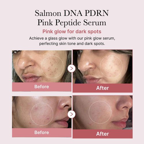 medicube Calm and Clear Skin Duo: medicube Mini Booster Pro Pink and Salmon DNA PDRN Pink Peptide Serum | Holiday Stocking Stuffers, Stocking Stuffers for Women, Gifts for Her