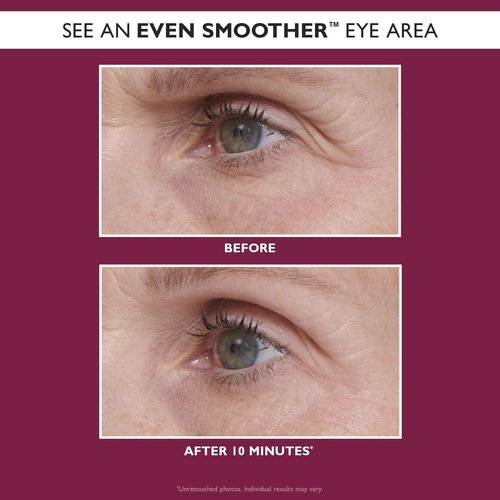 Peter Thomas Roth | Even Smoother™ Glycolic Retinol Hydra-Gel Eye Patches, Under-Eye Patches With Glycolic Acid and Retinol, Treats Tiny Bumps, Texture, Fine Lines and Wrinkles Under the Eye Area