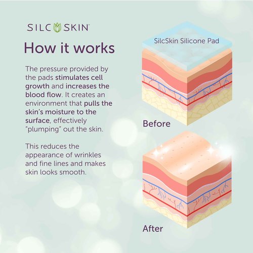 SilcSkin Silicone Eye Pads - Reusable Overnight Eye Patches, Medical-grade Silicone for Fine Lines, Crepey Skin, and Puffiness - 120 Day Supply