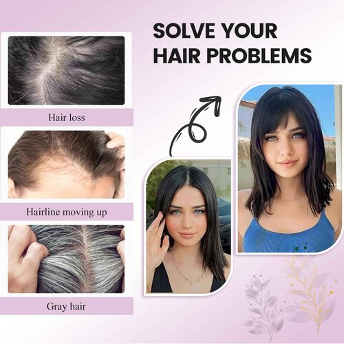 Human Hair Toppers with Bangs Hair Toppers for Women Remy Human Hair Hand-stitched 360°3D Coverage Natural for Thinning HairPieces for Women with Thinning Hair Swiss Base(4T4/27#)