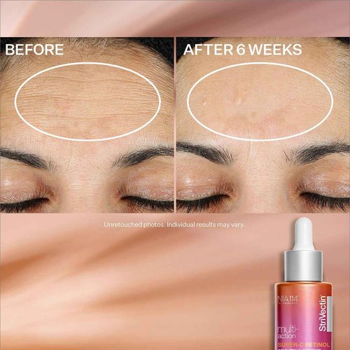 StriVectin Multi Action Super C Vitamin C Retinol Brightening & Correcting Face Serum