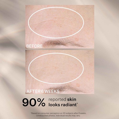 StriVectin Multi-Action Super-C SPF 30 Vitamin C Moisturizer and Daily Sunscreen for Brightening and Smoothing Fine Lines, 1.7 Fl Oz