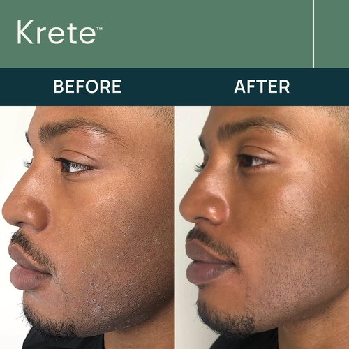 One-Two Punch with Probiotic Facial Cleanser & Facial Serum for Men – Moisturize, Hydrate, and Protect Your Skin in 30 Seconds