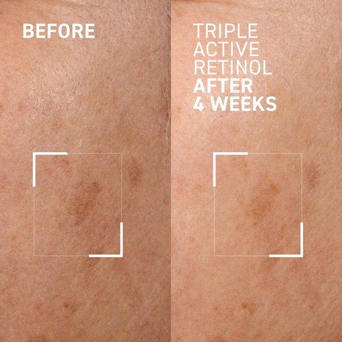 Dr. Brandt Skincare BTW Triple active retinol gentle overnight renewal cream 1 fl. oz. / 30 ml