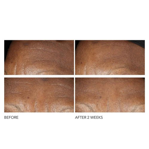 Dr Dennis Gross Advanced Retinol + Ferulic Intense Wrinkle Cream | Intensely Hydrating to Visibly Transform Skin and Repair the Moisture Barrier | 2 oz