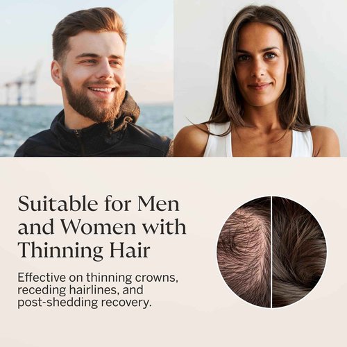 Happy Head Hair Regrowth Serum – Leave-In Scalp & Hair Treatment with Procapil®, Biotin & Rosemary – Lightweight Formula – 2oz