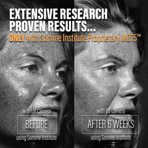 Exfoliating Glycolic Acid Pads | Anti-Aging, Smoothing, Resurfacing | Somme Institute Transport Alcohol-Free Brightening for Gentle Dirt Removal and Pore Cleansing | 50 Ct.