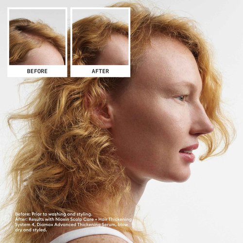 Nioxin System 4 Scalp Cleaning Shampoo and Therapy Conditioner Set for Color Treated Hair with Progressed Thinning